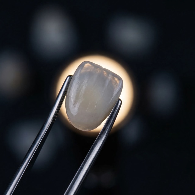 Zirconium Veneers